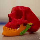 czaszka wydrukowana na drukarce 3D